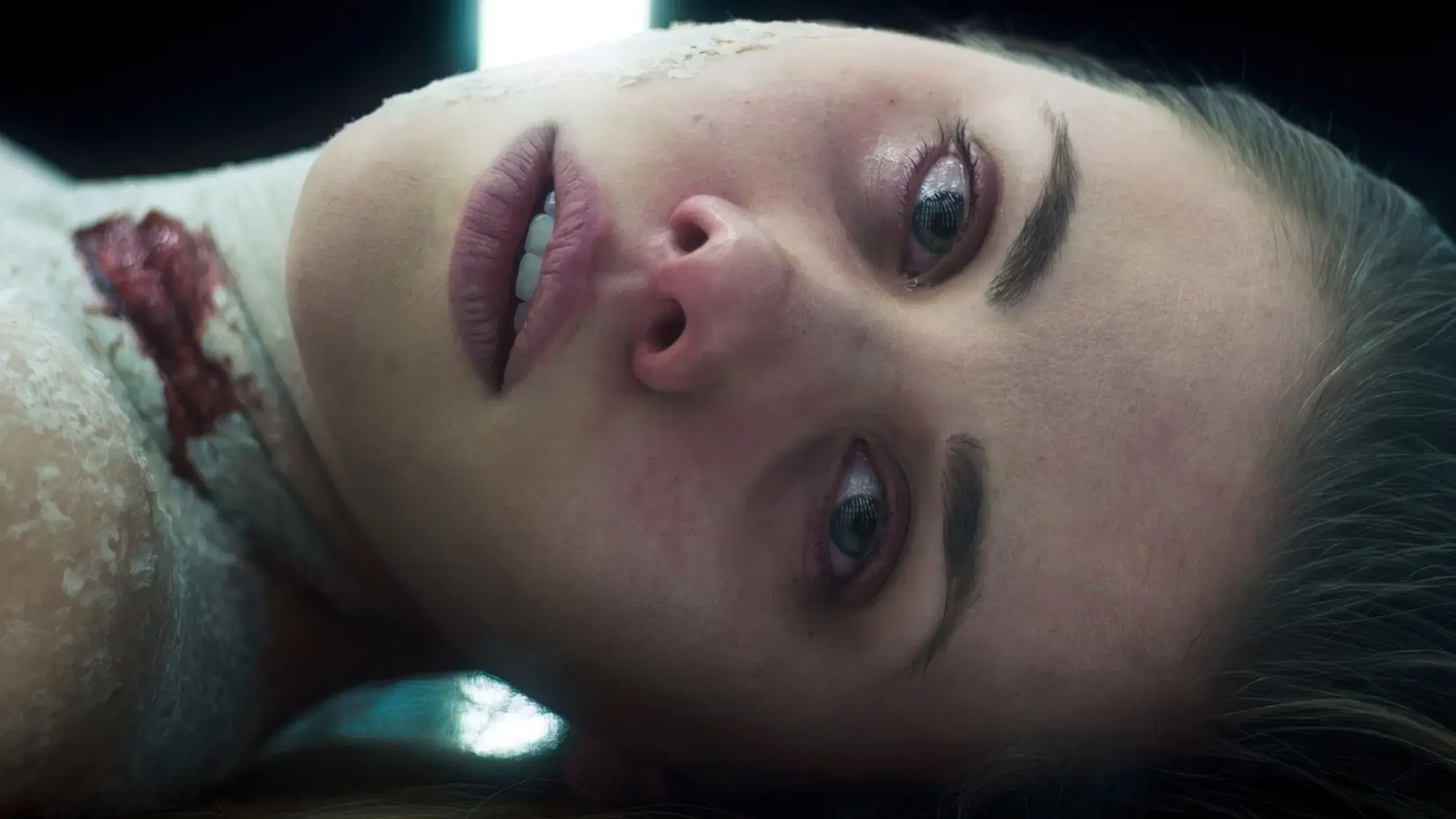 Replace - Maldição de Pele