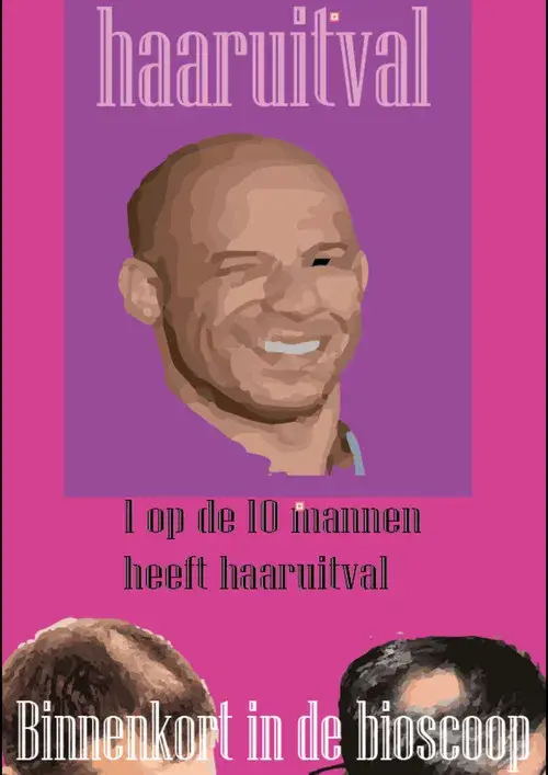 Kaal worden. Wat kan ik doen?